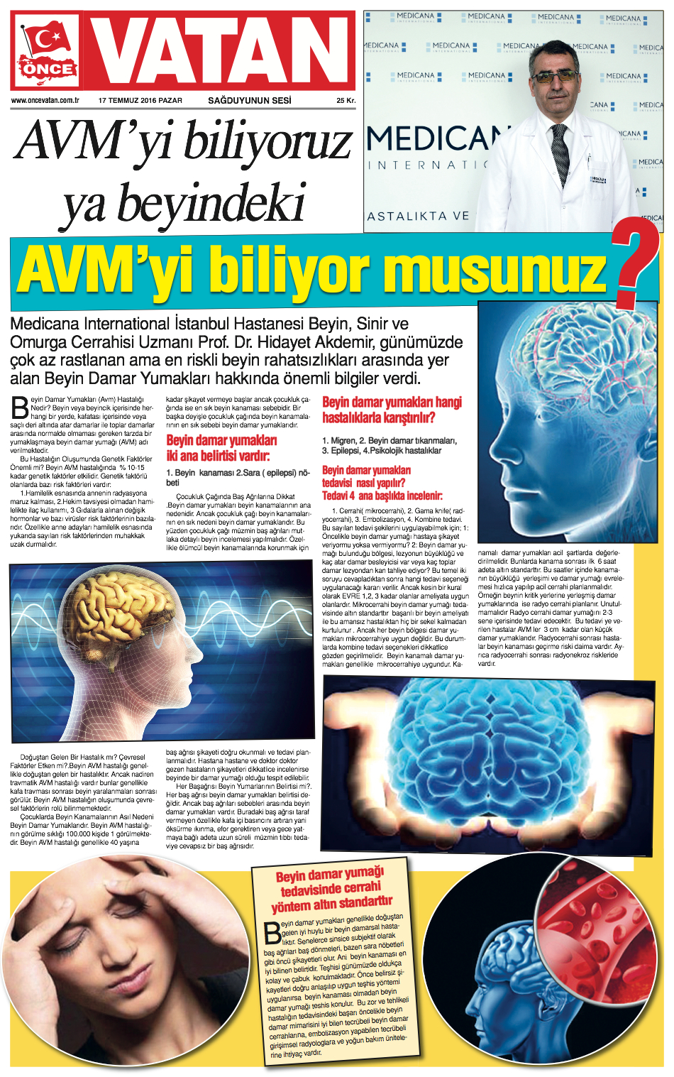 BEYİN DAMAR YUMAKLARI (AVM) CERRAHİSİ